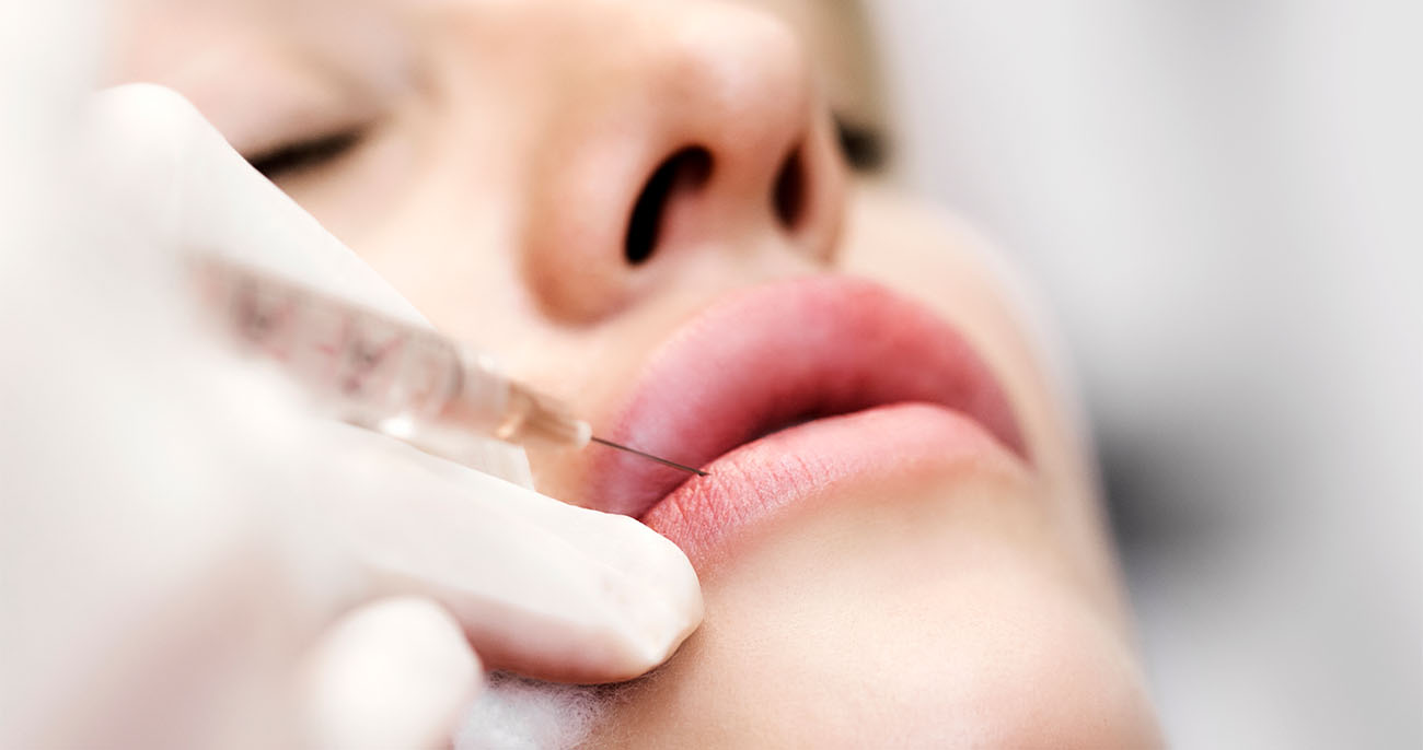 Face Fillers - Aesthetic Clinic Singapore