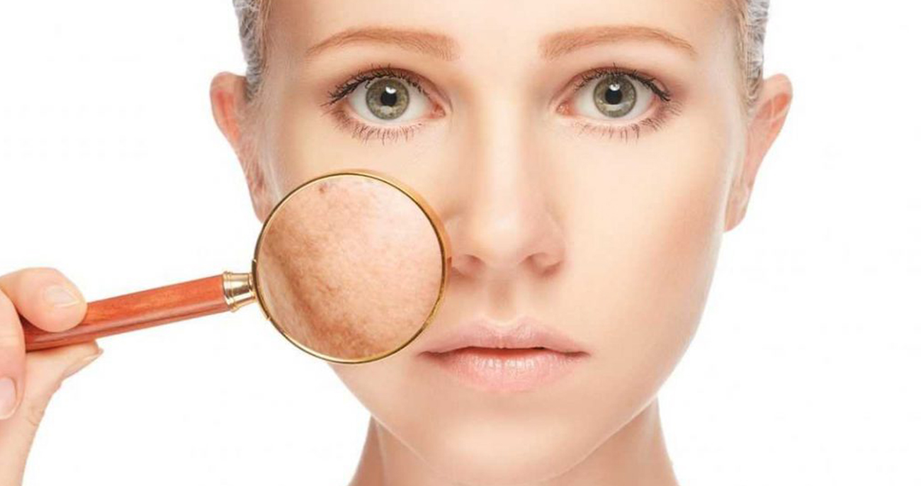Pigmentation Treatment